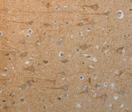 Anti-Human/Mouse/Rat SLC4A7 Antibody