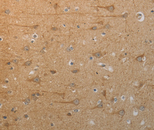 Anti-Human/Mouse/Rat SLC4A7 Antibody - ABMIUM