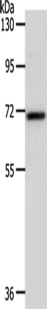 Anti-Human/Mouse SOX13 Antibody - ABMIUM