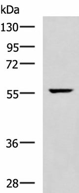 Western blot analysis of Mouse heart tissue lysate using TRAF6 Polyclonal Antibody at dilution of 1:300