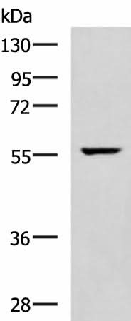 Western blot analysis of Mouse heart tissue lysate using TRAF6 Polyclonal Antibody at dilution of 1:300