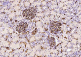 Anti-Human CD34 Antibody [A856] - ABMIUM