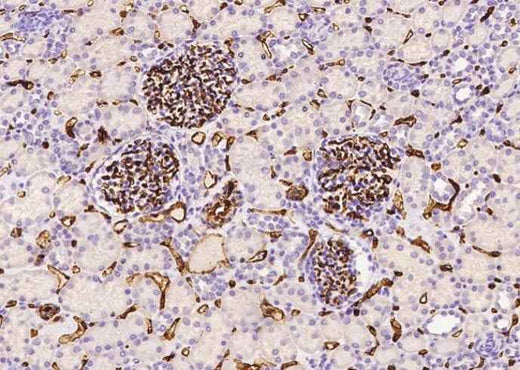Anti-Human CD34 Antibody [A856] - ABMIUM