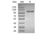 Recombinant Human IDE/Insulysin Protein (His Tag) - ABMIUM