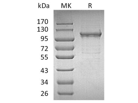 Recombinant Human IDE/Insulysin Protein (His Tag) - ABMIUM