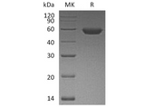 Recombinant Human ROR2 Protein (His Tag) - ABMIUM