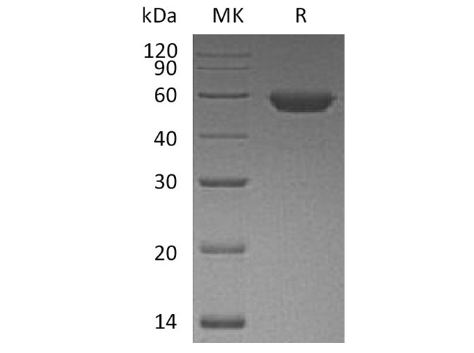 Recombinant Human ROR2 Protein (His Tag) - ABMIUM