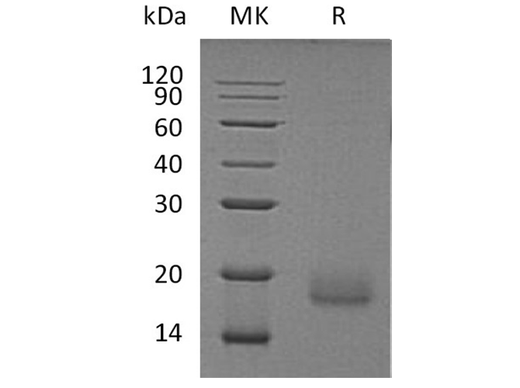 Recombinant Human ALK-2/ACVR1 Protein (Human Cells, His Tag) - ABMIUM