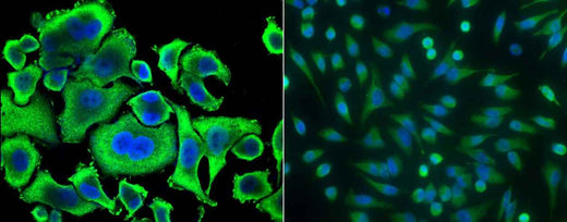 Anti-Human ACY1 Antibody [B264] - ABMIUM