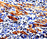 Anti-Human ACSBG2 Antibody - ABMIUM