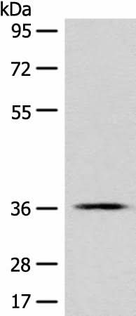 Western blot analysis of PC-3 cell lysate using GPR55 Polyclonal Antibody at dilution of 1:500
