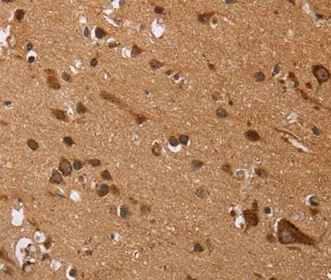 Anti-Human EDN3 Antibody