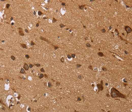 Anti-Human EDN3 Antibody