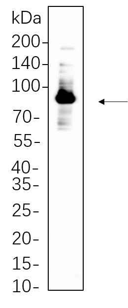 Anti-Human/Mouse/Rat Glycogen Synthase Antibody [B761] - ABMIUM