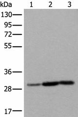 Western blot analysis of Human heart tissue A431 cell Human fetal liver tissue lysates using SNRPA Polyclonal Antibody at dilution of 1:550