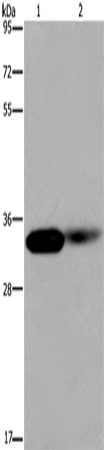 Anti-Human/Mouse LIMS1 Antibody - ABMIUM