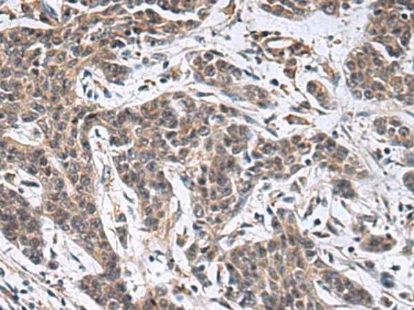 Anti-Human/Rat MBL2 Antibody