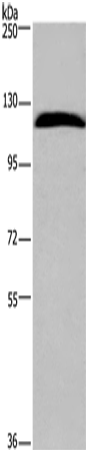 Anti-Human/Mouse IPO7 Antibody - ABMIUM