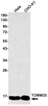 Western blot detection of TOMM20 in Hela,CHO-K1 cell lysates using TOMM20 Rabbit mAb(1:500 diluted).Predicted band size:16kDa.Observed band size:16kDa.