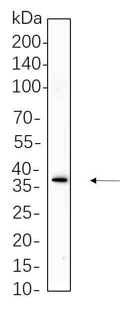 Anti-Human/Mouse/Rat Podoplanin Antibody [B676] - ABMIUM