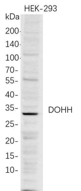 Anti-Human DOHH Antibody [B727]