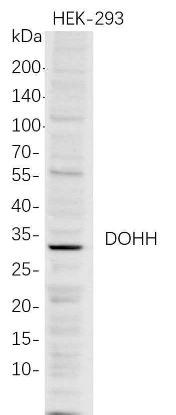 Anti-Human DOHH Antibody [B727] - ABMIUM