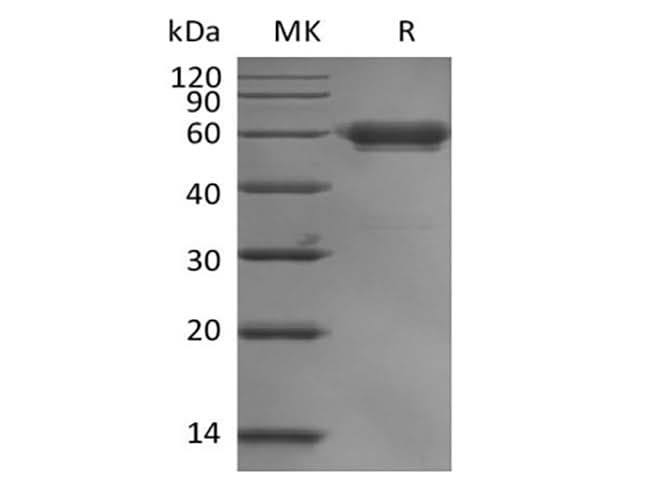 Recombinant Human Leukocyte-associated Immunoglobulin-like Receptor 1/LAIR1/CD305 (C-mFc) - ABMIUM