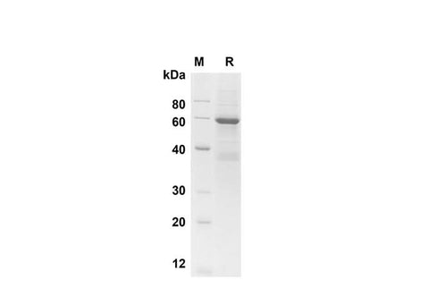 SDS-PAGE analysis of Human SP-A1 proteins , 2 μg/lane of Recombinant Human SP-A1 proteins was resolved with SDS-PAGE under reducing conditions , showing bands at 60 kDa.