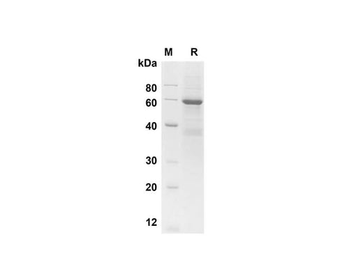 SDS-PAGE analysis of Human SP-A1 proteins , 2 μg/lane of Recombinant Human SP-A1 proteins was resolved with SDS-PAGE under reducing conditions , showing bands at 60 kDa.