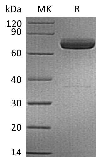 Recombinant Human IL-23 alpha & Mouse IL-12 beta Heterodimer (C-6His) - ABMIUM