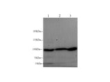 Anti-Mouse/Rat ST14 Antibody - ABMIUM