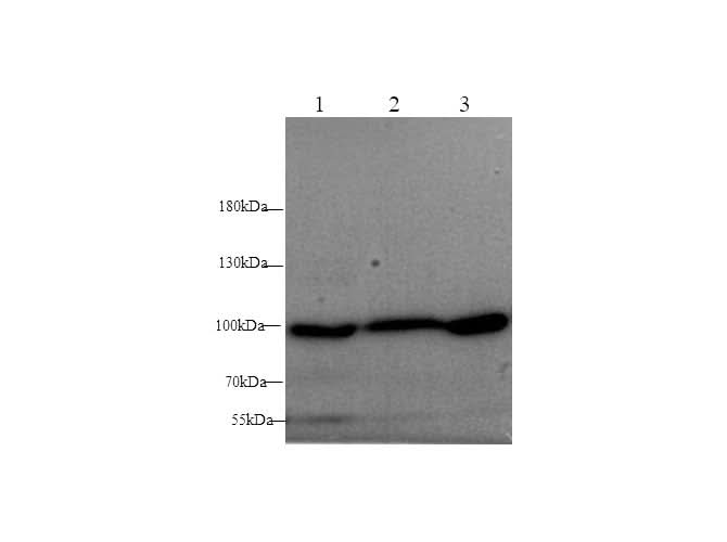 Anti-Mouse/Rat ST14 Antibody - ABMIUM