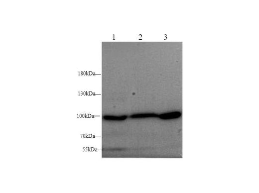 Anti-Mouse/Rat ST14 Antibody - ABMIUM