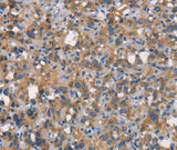 Anti-Human CEACAM6 Antibody - ABMIUM