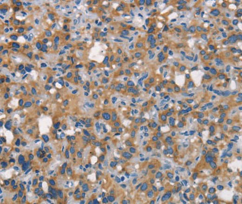 Anti-Human CEACAM6 Antibody - ABMIUM