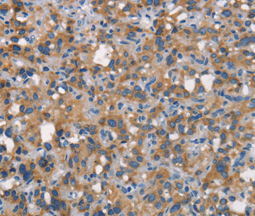 Anti-Human CEACAM6 Antibody - ABMIUM