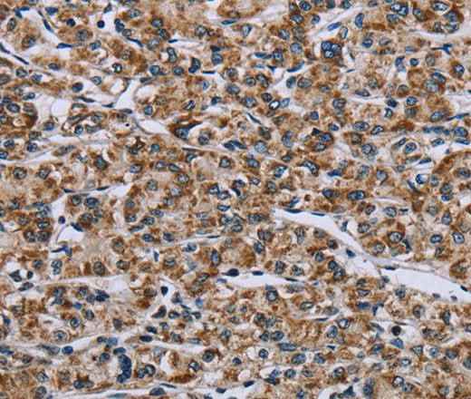 Anti-Human GTPBP10 Antibody