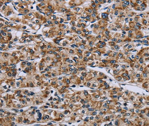 Anti-Human GTPBP10 Antibody - ABMIUM