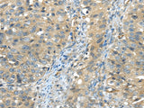 Anti-Human ISM2 Antibody - ABMIUM