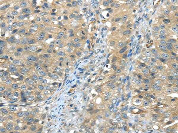 Anti-Human ISM2 Antibody
