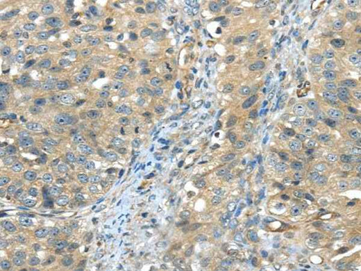 Anti-Human ISM2 Antibody