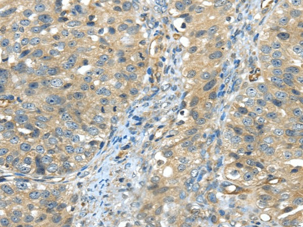Anti-Human ISM2 Antibody - ABMIUM