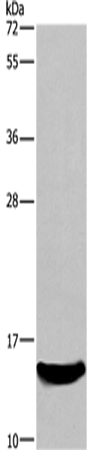 Anti-Human/Mouse/Rat AIF1 Antibody - ABMIUM