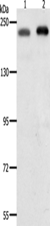 Anti-Human/Mouse/Rat SMARCA4 Antibody - ABMIUM