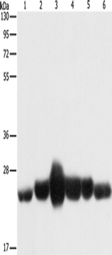 Anti-Human/Mouse/Rat CAV1 Antibody - ABMIUM