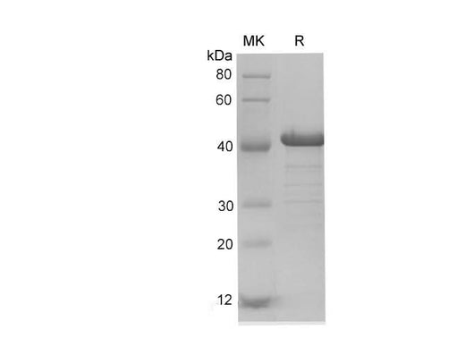 SDS-PAGE analysis of Human PDCD4 proteins, 2 μg/lane of Recombinant Human PDCD4 proteins was resolved with SDS-PAGE under reducing conditions, showing bands at 41-43 kDa.