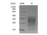 Recombinant Mouse Interleukin-13/IL-13 Protein (His Tag) - ABMIUM