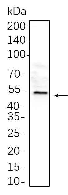 Anti-Human/Mouse/Rat Desmin Antibody [B1080] - ABMIUM