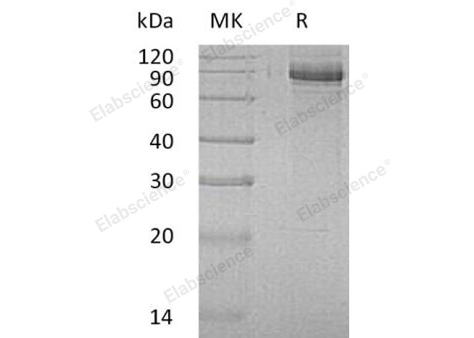 Recombinant Human INPP1 Protein (His Tag) - ABMIUM