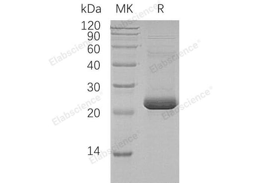 Recombinant Human ASF1A Protein (His&T7 Tag) - ABMIUM